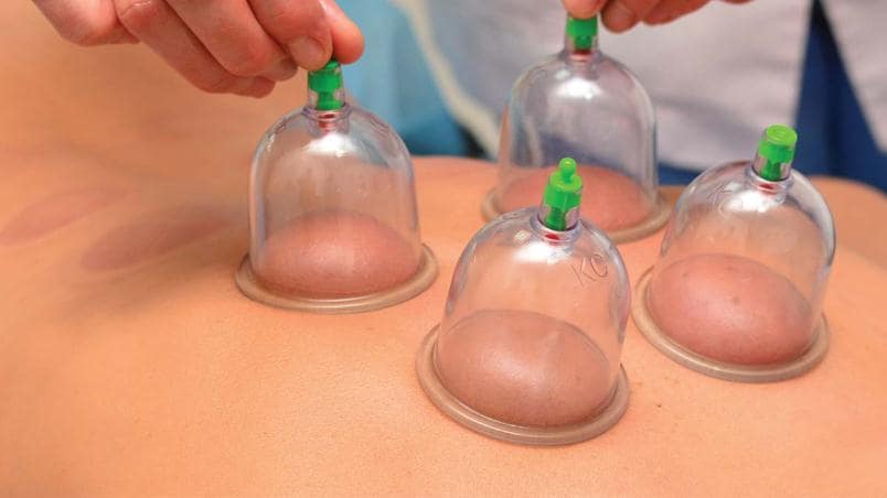 Honey Cupping Massage Therapy